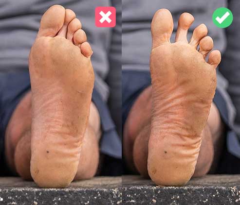 Ejercicios Para Separar Los Dedos De Los Pies