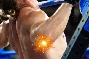 crossfit elbow injuries